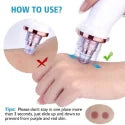 USB Rechargeable Electric Blackhead Remover & Pore Vacuum